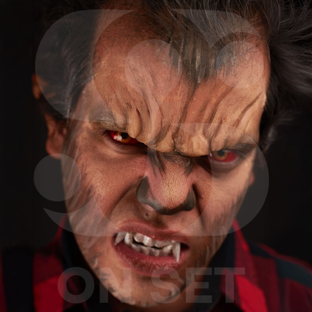 (ONSET) Prostético de Frente de Lobo