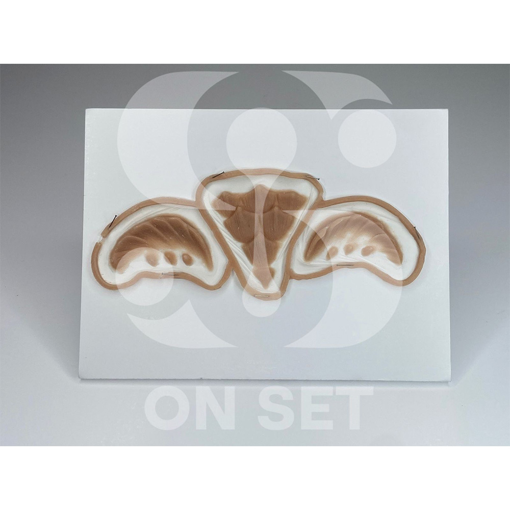 Prostético de Frente de Sirena