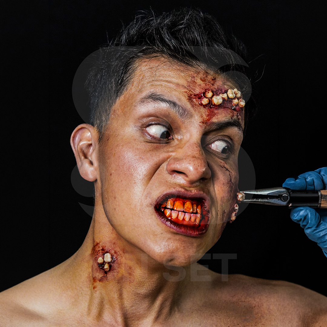 (ONSET) Prostético de Dientes