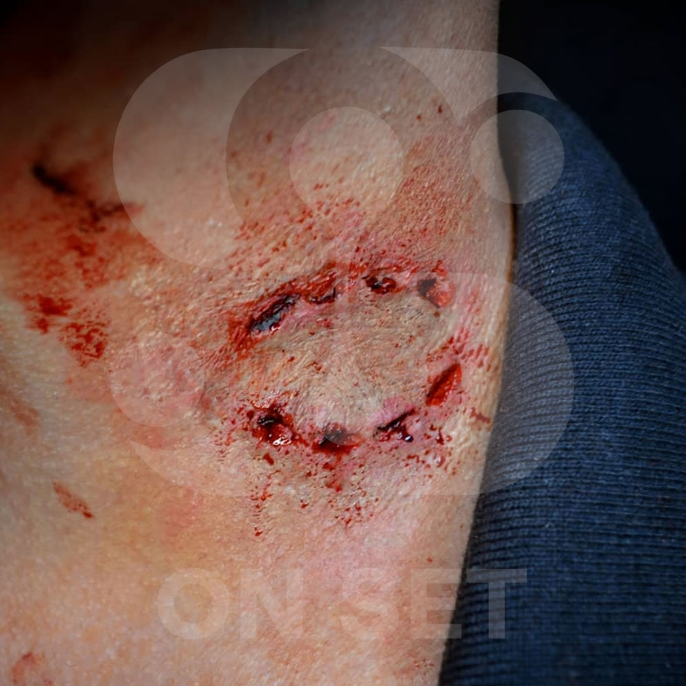 (ONSET) Prostético de Mordida Zombie Chica