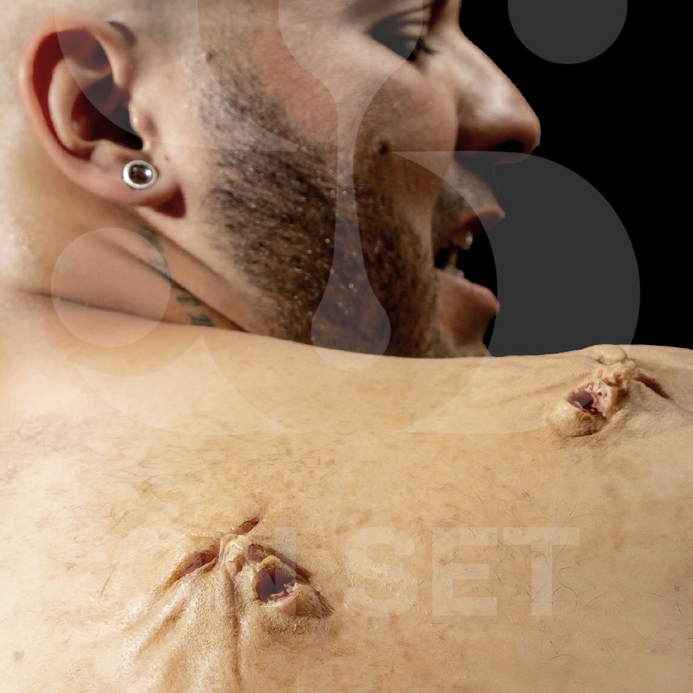 (ONSET) Prostético de Caras Emergentes