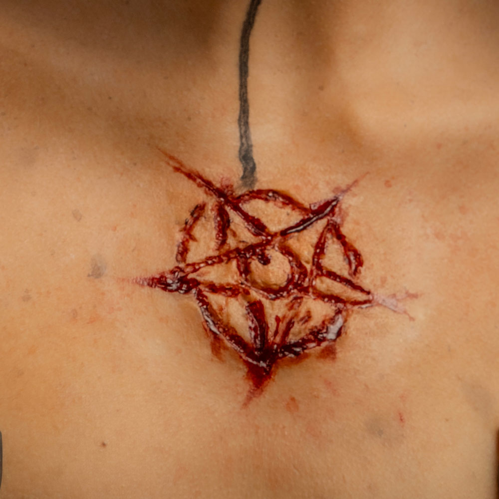 Prostético de Pentagrama