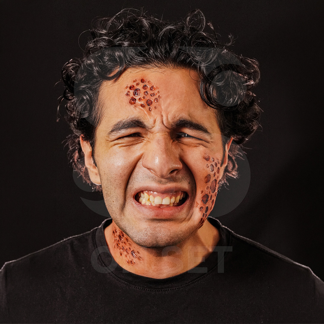 (ONSET) Prostético Tripofobia